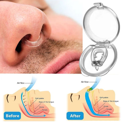 ComfoRelax Anti-Snoring Corrector Snore Prevention Gadget Women's Anti-Snore Device Snore Elimination Nose Clip Men's Sleep Night